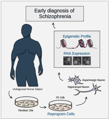 The Perspectives of Early Diagnosis of Schizophrenia Through the Detection of Epigenomics-Based Biomarkers in iPSC-Derived Neurons